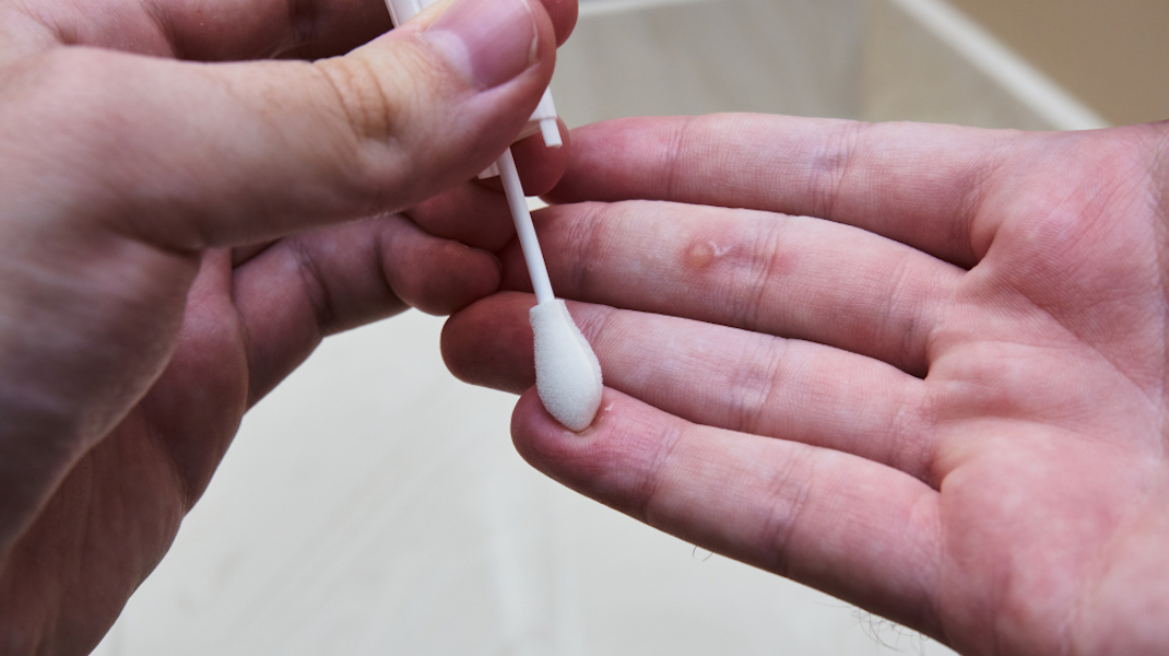 himmelen-Produit verrue : comment traiter ce problème naturellement ?