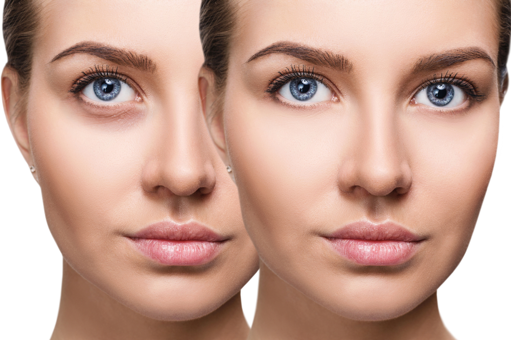 Poche sous les yeux : comment réparer votre peau ?