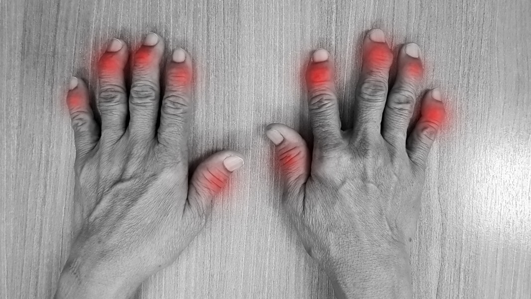 himmelen-Arthrose et ses symptômes : comment reconnaître l'usure du cartilage ?