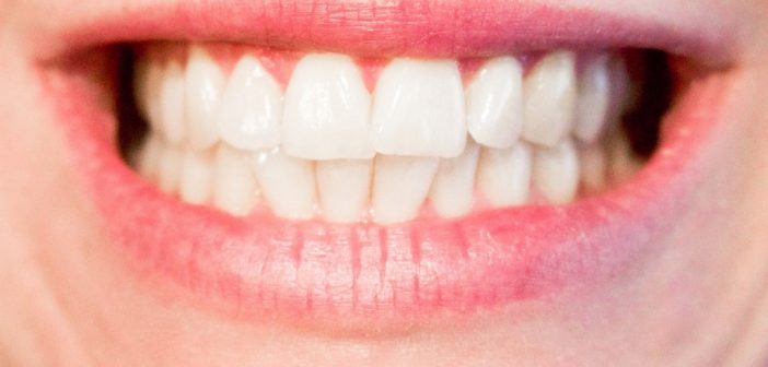 Les avantages des implants dentaires