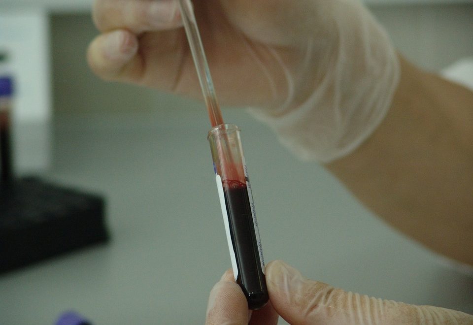 himmelen-Le dépistage du SIDA : un test indispensable et sans risque