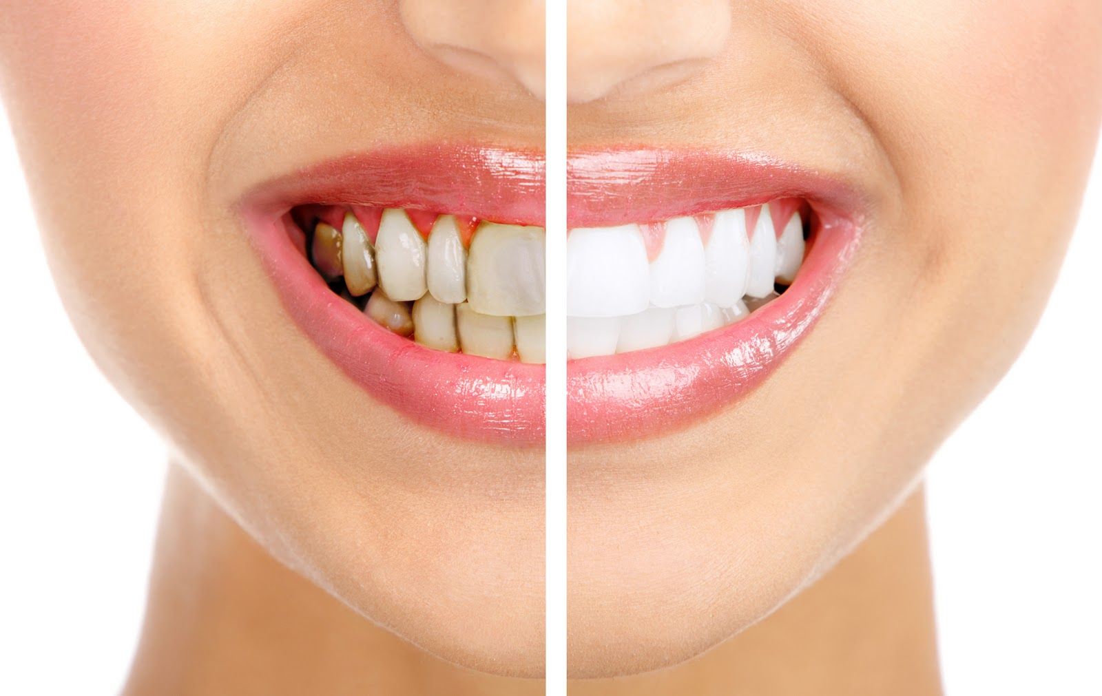 Qu'est-ce que l’esthétique dentaire ?