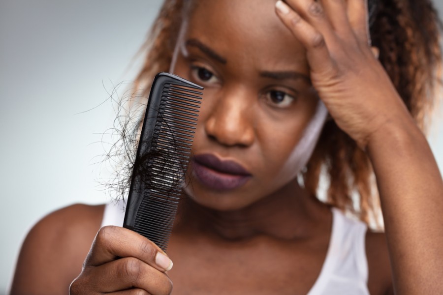 himmelen-L'alopécie des cheveux crépus : tout savoir !