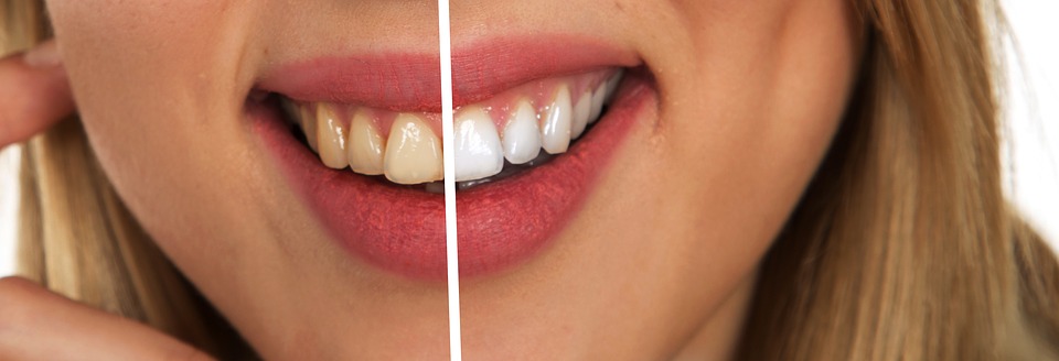 La relation entre les dents et la santé